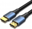  Vention HDMI Ultra High Speed v2.1 with Ethernet 19M/19M - 1.5